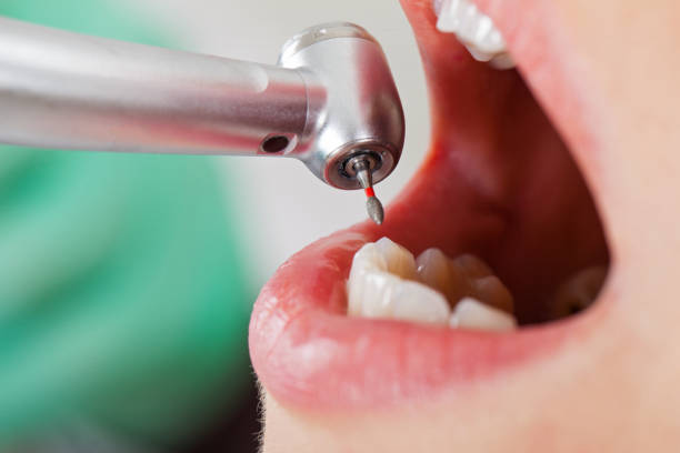 Best Emergency Gum Treatment in Hanover, OH